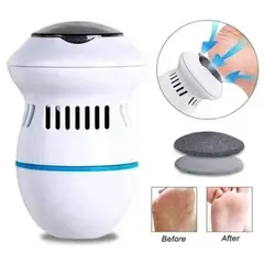 GENERICO - Removedor Eléctrico Amolador Pies Saca Quita Callos Usb Recarga…